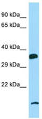 Pyrimidinergic Receptor P2Y6 antibody, TA334342, Origene, Western Blot image 