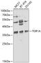 Torsin Family 1 Member A antibody, 18-475, ProSci, Western Blot image 