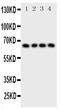 Parathyroid Hormone 1 Receptor antibody, PA2132, Boster Biological Technology, Western Blot image 