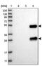 Semaphorin-3D antibody, PA5-57986, Invitrogen Antibodies, Western Blot image 