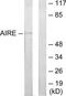 Autoimmune Regulator antibody, TA313460, Origene, Western Blot image 