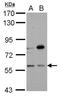 Beta-Ala-His dipeptidase antibody, NBP2-15925, Novus Biologicals, Western Blot image 