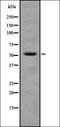 Fascin Actin-Bundling Protein 1 antibody, orb336963, Biorbyt, Western Blot image 