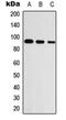 Unc-5 Netrin Receptor A antibody, orb234978, Biorbyt, Western Blot image 