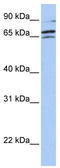 A-Raf Proto-Oncogene, Serine/Threonine Kinase antibody, TA335018, Origene, Western Blot image 