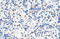 IKAROS Family Zinc Finger 3 antibody, ARP39004_P050, Aviva Systems Biology, Immunohistochemistry paraffin image 