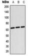 Testis Associated Actin Remodelling Kinase 2 antibody, orb360737, Biorbyt, Western Blot image 