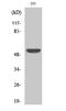 X-Linked Inhibitor Of Apoptosis antibody, STJ96278, St John