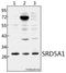 Steroid 5 Alpha-Reductase 1 antibody, A03464, Boster Biological Technology, Western Blot image 