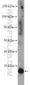 Ras Homolog Family Member V antibody, 26620-1-AP, Proteintech Group, Western Blot image 