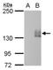 mCherry Tag  antibody, NBP2-43778, Novus Biologicals, Western Blot image 