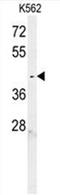 Chromosome 6 Open Reading Frame 58 antibody, AP50659PU-N, Origene, Western Blot image 