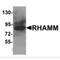 Hyaluronan mediated motility receptor antibody, MBS151400, MyBioSource, Western Blot image 