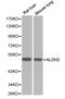 Aldehyde dehydrogenase, mitochondrial antibody, LS-C192488, Lifespan Biosciences, Western Blot image 