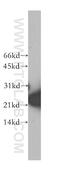 S-Phase Kinase Associated Protein 1 antibody, 10990-2-AP, Proteintech Group, Western Blot image 