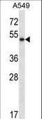 Pancreatic Lipase antibody, LS-B13769, Lifespan Biosciences, Western Blot image 