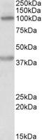 Zinc Finger E-Box Binding Homeobox 2 antibody, EB10813, Everest Biotech, Western Blot image 