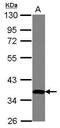 Zinc Finger Protein 177 antibody, PA5-31942, Invitrogen Antibodies, Western Blot image 