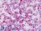 Calpain Small Subunit 2 antibody, LS-B9156, Lifespan Biosciences, Immunohistochemistry paraffin image 