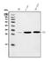 Carbonic Anhydrase 1 antibody, M00170-2, Boster Biological Technology, Western Blot image 