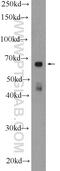 Lipase Maturation Factor 1 antibody, 16812-1-AP, Proteintech Group, Western Blot image 