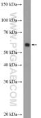 Homeobox protein ARX antibody, 20739-1-AP, Proteintech Group, Western Blot image 