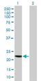 Coiled-Coil Domain Containing 115 antibody, H00084317-B01P, Novus Biologicals, Western Blot image 