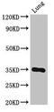 Dolichol-phosphate mannosyltransferase antibody, orb400196, Biorbyt, Western Blot image 