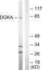 Diacylglycerol Kinase Alpha antibody, abx013437, Abbexa, Western Blot image 