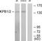 Phosphorylase Kinase Regulatory Subunit Alpha 1 antibody, TA313395, Origene, Western Blot image 