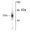 Tryptophan Hydroxylase 1 antibody, AHP930, Bio-Rad (formerly AbD Serotec) , Immunohistochemistry frozen image 