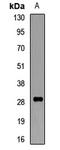 CD16 antibody, orb412115, Biorbyt, Western Blot image 