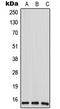 Acidic Nuclear Phosphoprotein 32 Family Member D antibody, GTX55938, GeneTex, Western Blot image 