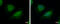 Lysine Acetyltransferase 14 antibody, GTX118397, GeneTex, Immunofluorescence image 