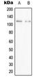 PPFIA Binding Protein 1 antibody, LS-C353054, Lifespan Biosciences, Western Blot image 