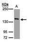 c-met antibody, PA5-27235, Invitrogen Antibodies, Western Blot image 