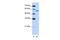 Zinc Finger CCCH-Type, RNA Binding Motif And Serine/Arginine Rich 2 antibody, GTX47366, GeneTex, Western Blot image 