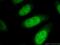 Cell Division Cycle Associated 2 antibody, 17701-1-AP, Proteintech Group, Immunofluorescence image 