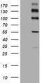 ALK Receptor Tyrosine Kinase antibody, CF801288, Origene, Western Blot image 