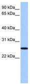 F-Box Protein 36 antibody, TA337764, Origene, Western Blot image 