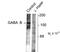 Gamma-Aminobutyric Acid Type B Receptor Subunit 2 antibody, TA309142, Origene, Western Blot image 