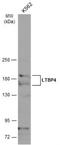 Latent Transforming Growth Factor Beta Binding Protein 4 antibody, NBP2-43671, Novus Biologicals, Western Blot image 
