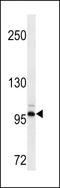 Discoidin Domain Receptor Tyrosine Kinase 2 antibody, LS-C159445, Lifespan Biosciences, Western Blot image 