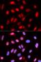 Histidine Decarboxylase antibody, orb167371, Biorbyt, Immunocytochemistry image 