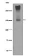 Glutamate Metabotropic Receptor 5 antibody, M01338, Boster Biological Technology, Western Blot image 