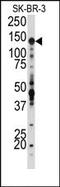 Insulin Like Growth Factor 1 Receptor antibody, AP14361PU-N, Origene, Western Blot image 