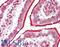 Dehydrogenase/Reductase 12 antibody, LS-B11562, Lifespan Biosciences, Immunohistochemistry paraffin image 