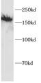 Integrin Subunit Alpha L antibody, FNab10427, FineTest, Western Blot image 