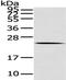 ADP Ribosylation Factor Like GTPase 2 antibody, TA323130, Origene, Western Blot image 