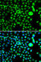 Structural Maintenance Of Chromosomes Flexible Hinge Domain Containing 1 antibody, 22-790, ProSci, Immunofluorescence image 